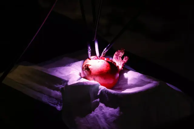 Der neue OP‑Roboter „Da Vinci“ im Krankenhaus der Barmherzigen Brüder in Graz zeigt am Granatapfel, wie präzise moderne Medizintechnik arbeitet. Unterstützt von KI‑basierten Assistenzsystemen hilft er ÄrztInnen, Eingriffe noch sicherer und schonender durchzuführen. 
 | Foto: Neuhold